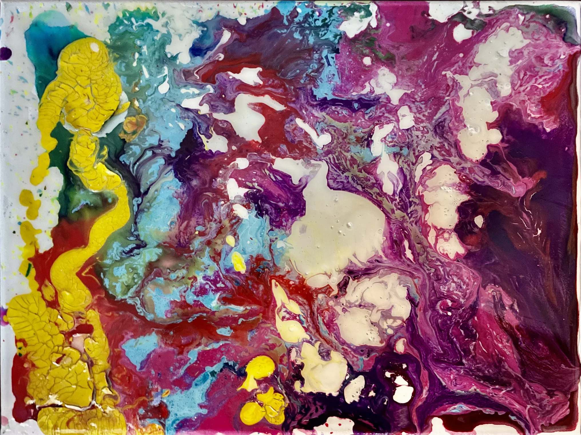 This vibrant work of art features a bold, swirling yellow alongside aqua, green, baby blue, red, pink, purple, and white. It was created as a special therapy session using the unlikely g-tube as the method of application. This was done as a child life specialist explained the upcoming procedure to remove Meg’s g-tube, marking a milestone in her recovery.